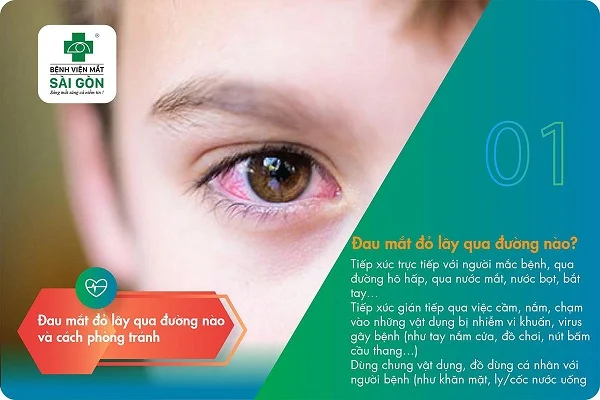 Bệnh đau mắt đỏ có thể lây truyền qua nhiều đường